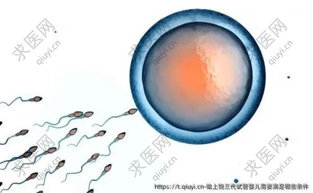 做上饶三代试管婴儿需要满足哪些条件