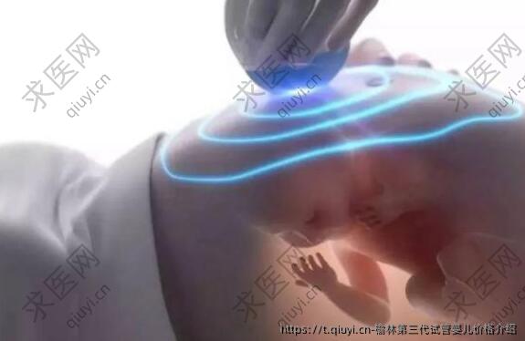 榆林三：代试管婴儿价格介绍