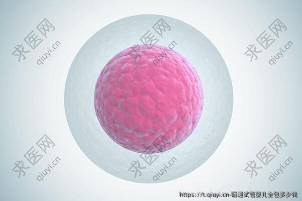 昭通试管婴儿全包多少钱