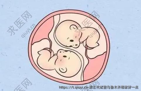 第三代试管乌鲁木齐哪家好一点