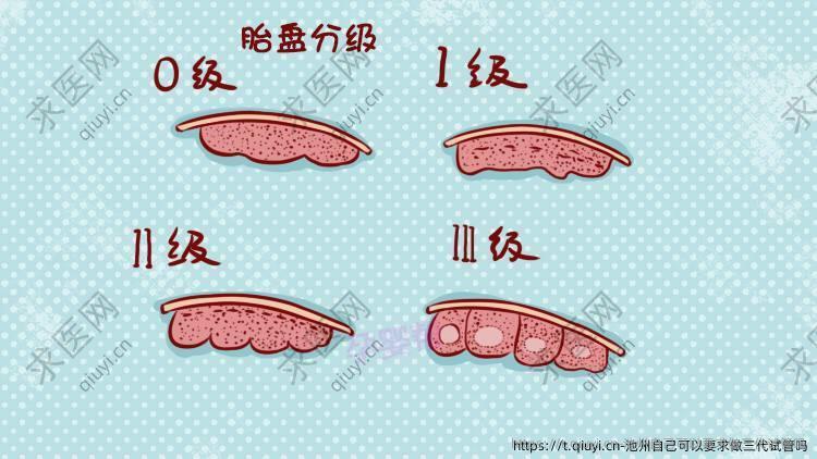 池州自己可以要求做三代试管吗