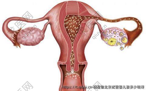 现在做北京试管婴儿要多少钱呀