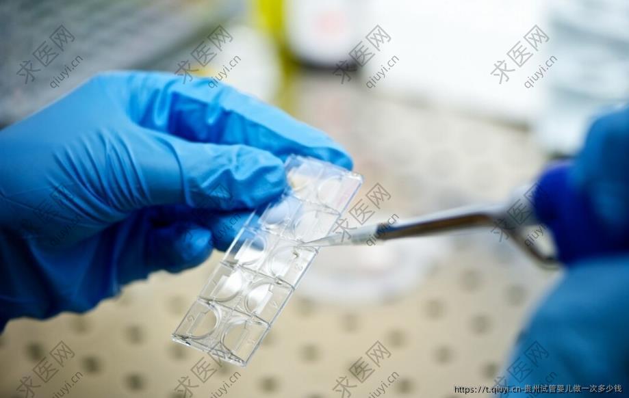 贵州试管婴儿做一次多少钱