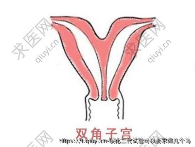绥化三代试管可以要求做几个吗