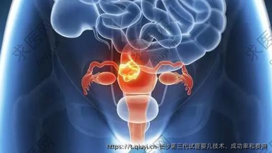 长沙第三代试管婴儿技术、成功率和费用