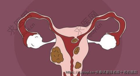 长春试管排名前十名的医院