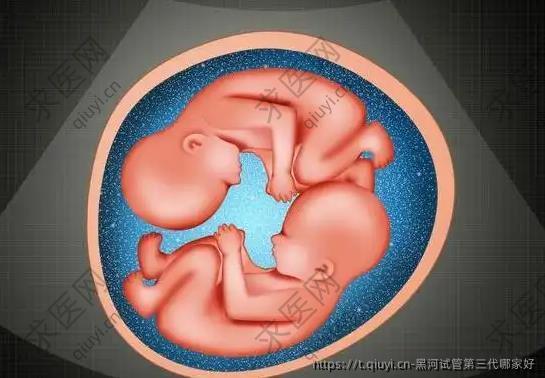 黑河试管第三代哪家好