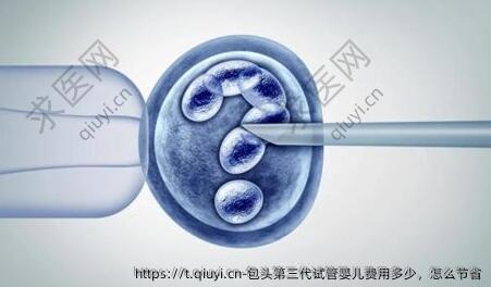 包头第三代试管婴儿费用多少，怎么节省