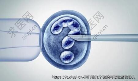 荆门哪几个医院可以做试管婴儿