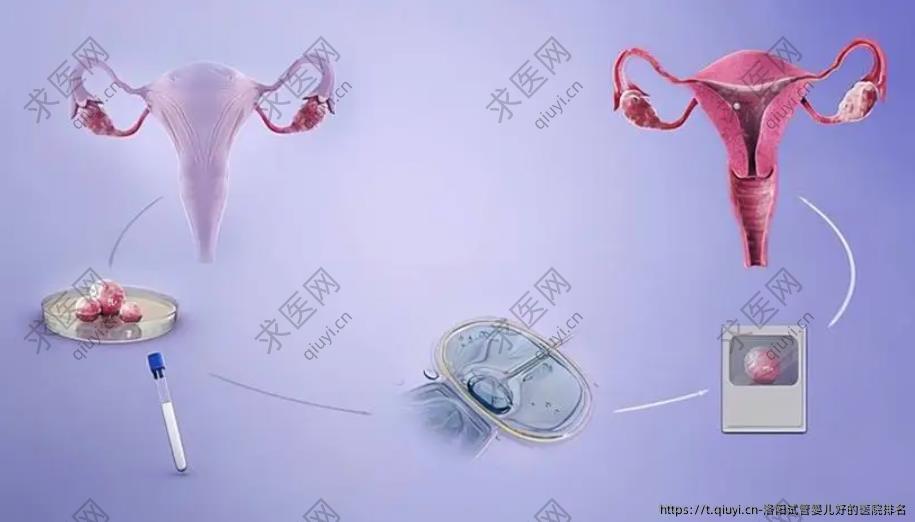洛阳试管婴儿好的医院排名