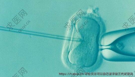 呼伦贝尔可以自己要求做三代试管吗