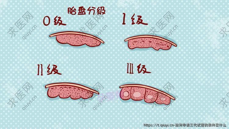 滁州申请三代试管的条件是什么