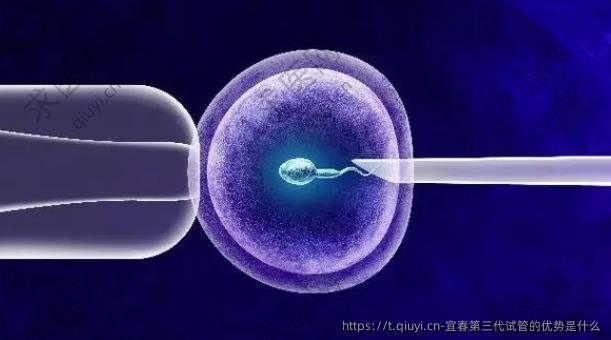宜春第三代试管的优势是什么
