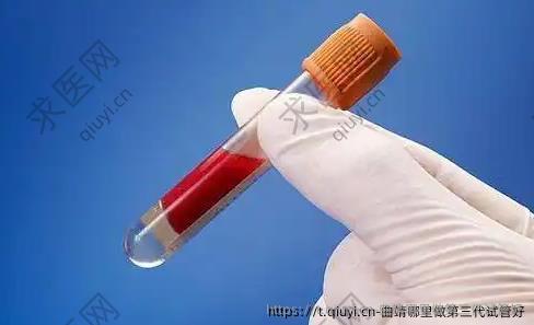 曲靖哪里做第三代试管好