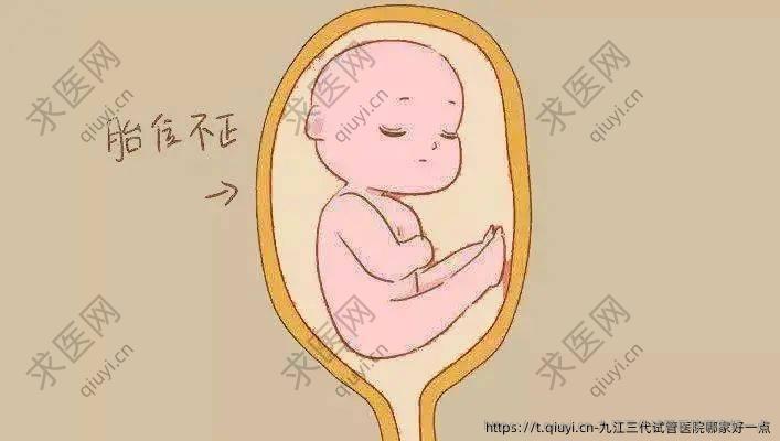 九江三代试管医院哪家好一点