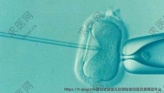 邢台试管婴儿前期检查项目及费用是什么