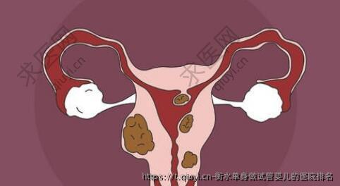 衡水单身做试管婴儿的医院排名