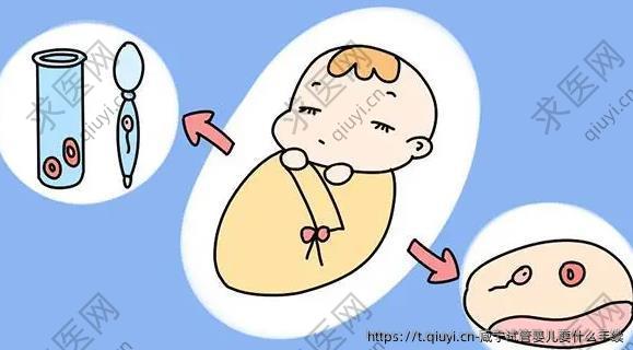 咸宁试管婴儿要什么手续