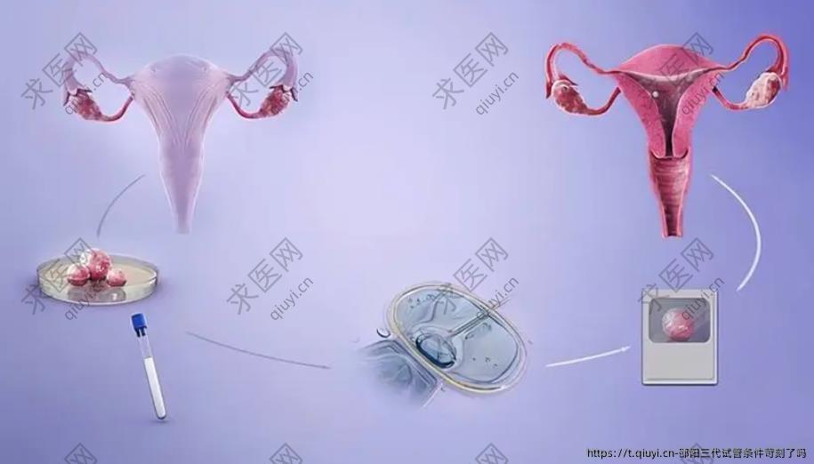 邵阳三代试管条件苛刻了吗