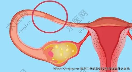 宿州三代试管对女性身体有什么要求