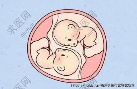 株洲第三代试管成功率