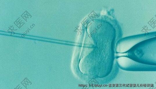 吉安三：代试管婴儿价格详细