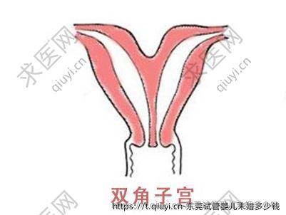 东莞试管婴儿未婚多少钱