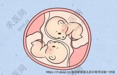 清远试管婴儿多少钱可以做一次呢