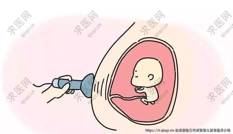 去成都做三代试管婴儿要准备多少钱