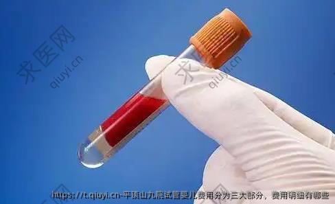 平顶山九院试管婴儿费用分为三大部分，费用明细有哪些