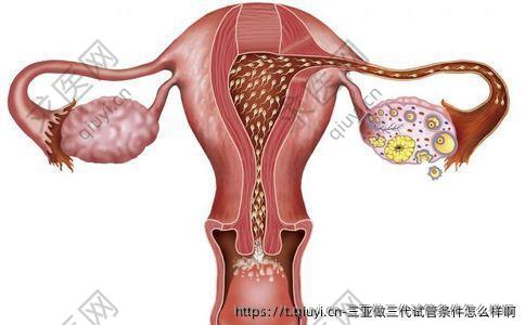 三亚做三代试管条件怎么样啊