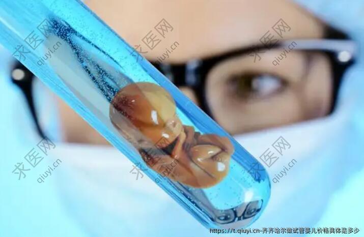 齐齐哈尔做试管婴儿价格具体是多少