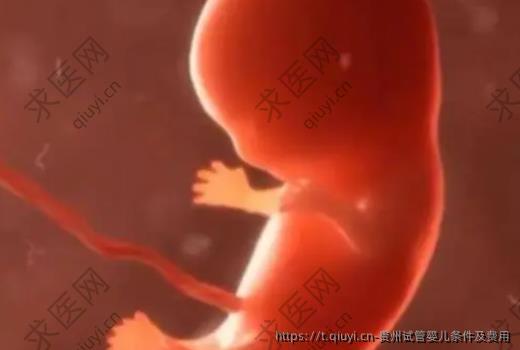 贵州试管婴儿条件及费用