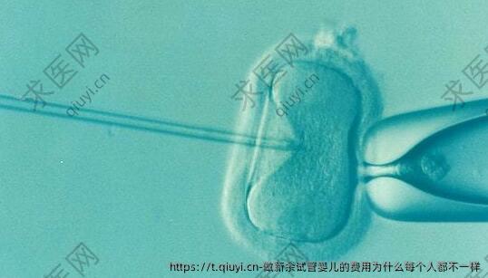 做新余试管婴儿的费用为什么每个人都不一样