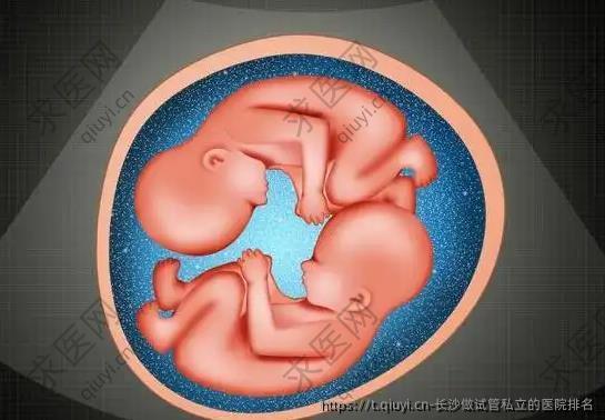 长沙做试管私立的医院排名