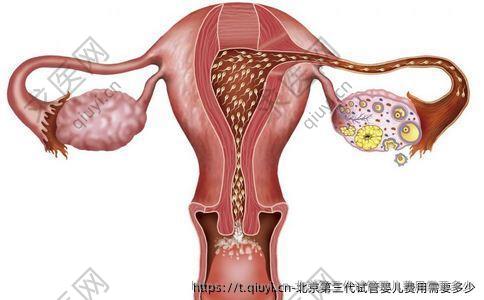 北京第三代试管婴儿费用需要多少
