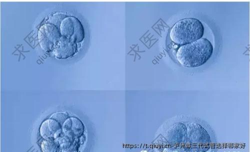 泸州做三代试管选择哪家好