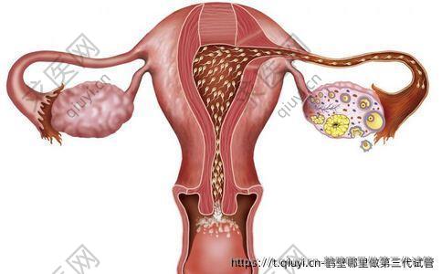 鹤壁哪里做第三代试管