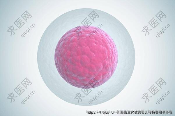 北海第三代试管婴儿移植费用多少钱