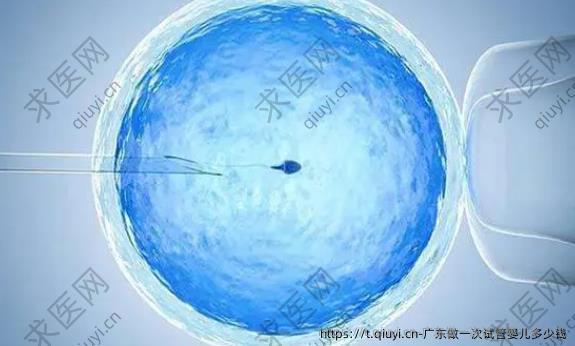 广东做一次试管婴儿多少钱