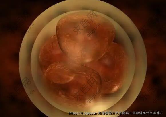 珠海做第三代试管婴儿需要满足什么条件？