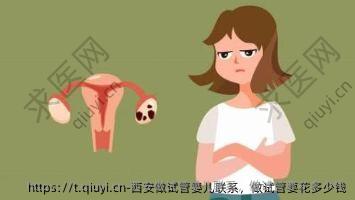 西安做试管婴儿联系，做试管要花多少钱
