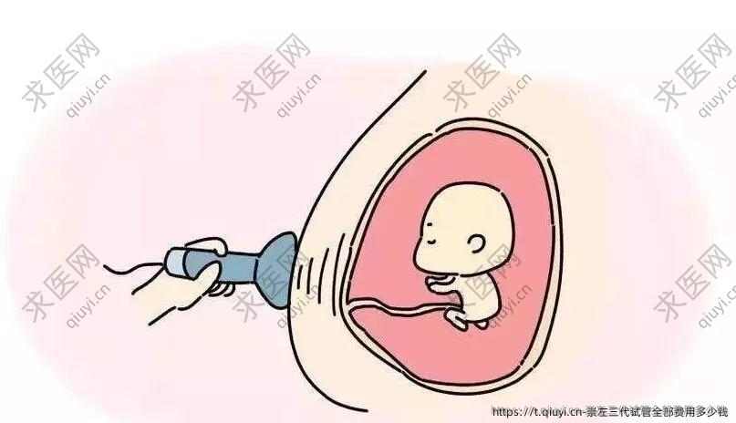 崇左三代试管全部费用多少钱