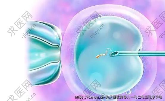 通辽做试管婴儿一代二代三代多少钱