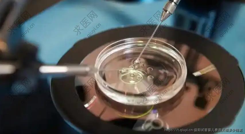 益阳试管婴儿费用大概多少钱呢