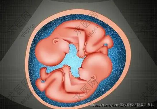 攀枝花做试管婴儿条件