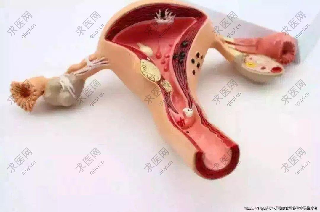 辽阳做试管便宜的医院排名