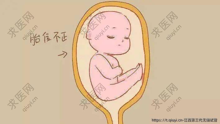 江西第三代无痛试管
