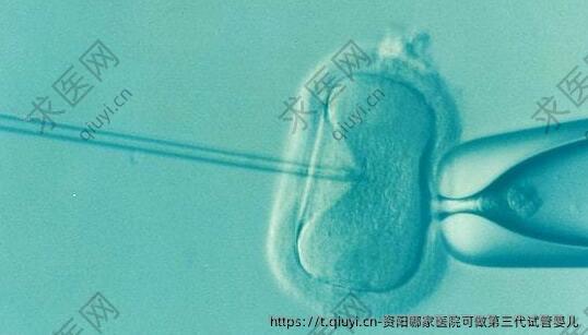 资阳哪家医院可做第三代试管婴儿