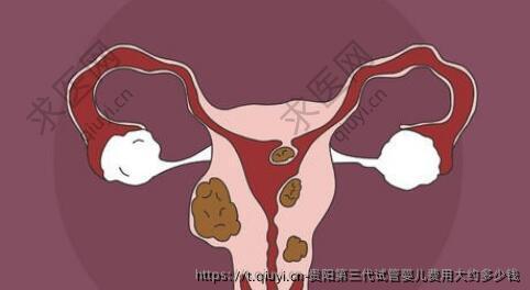 贵阳第三代试管婴儿费用大约多少钱